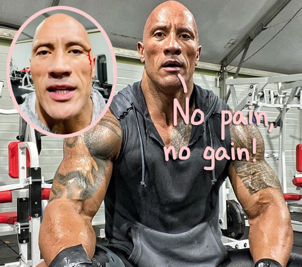 The Rock Hit The Gym A Little TOO Hard This Time - See The Bloody Injury  Video! - Perez Hilton